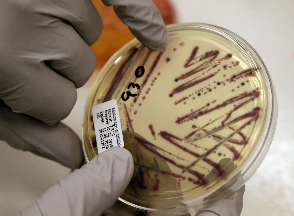 15 States See Alfalfa Sprout Food-Poisoning Outbreak, Kidney Failure Concerns